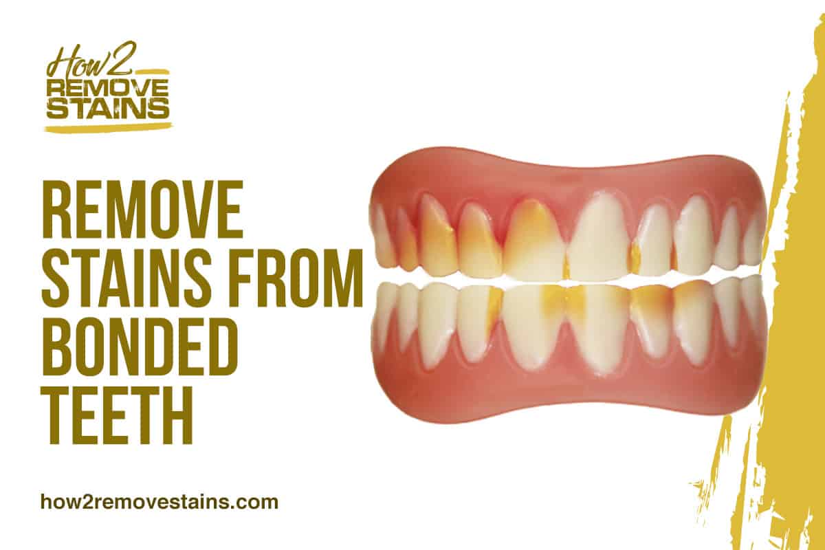 How to Remove Stains from Bonded Teeth