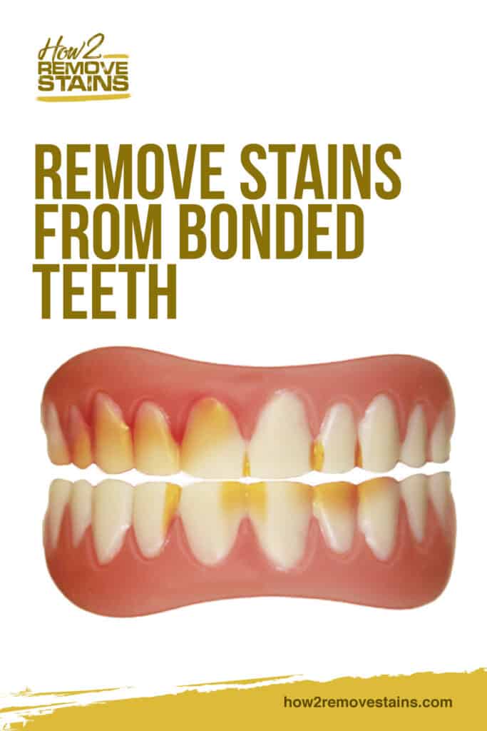 How to Remove Stains from Bonded Teeth