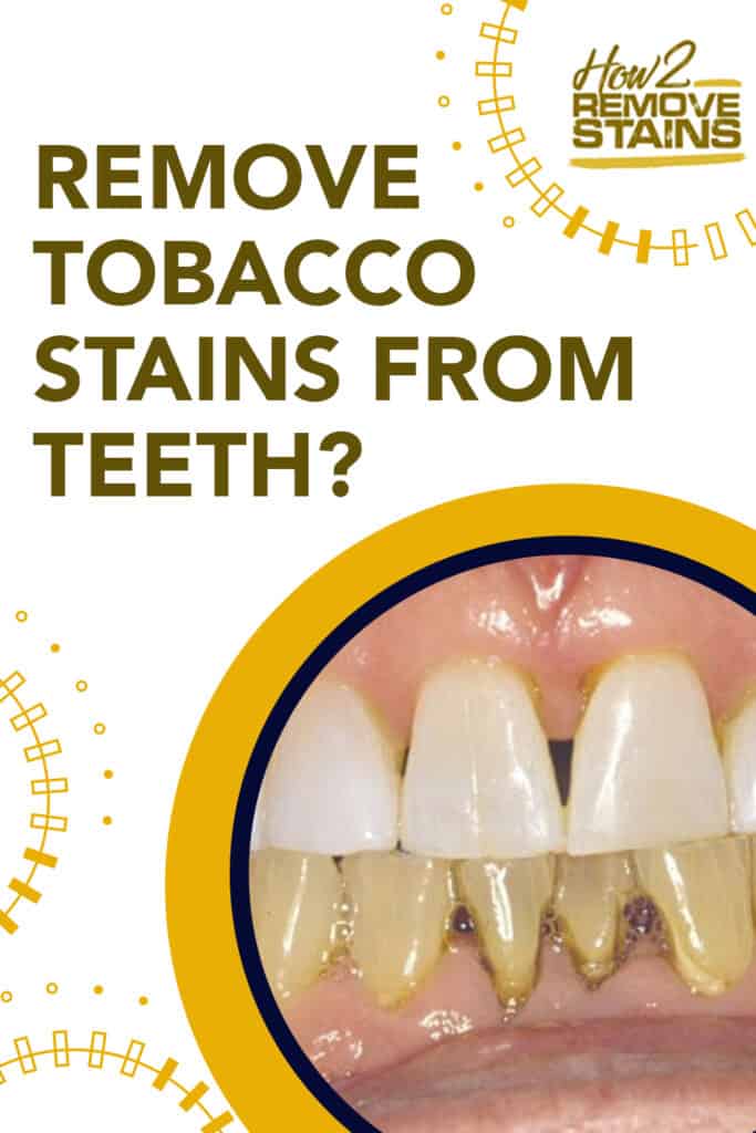 how to remove tobacco stains from teeth
